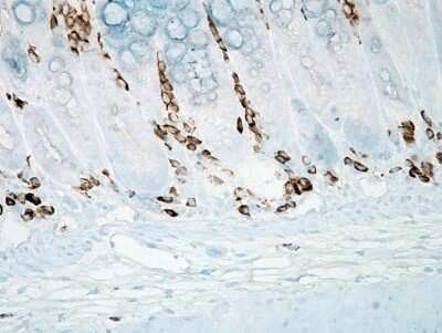 Immunohistochemistry: Nitrotyrosine Antibody (39B6) [NB110-96877]