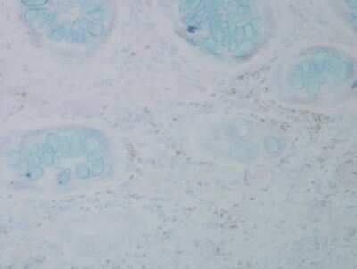 Immunohistochemistry: Nitrotyrosine Antibody (39B6) [NB110-96877]