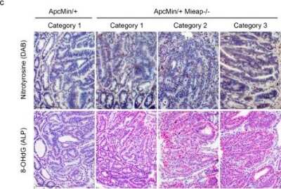 Immunohistochemistry-Paraffin: Nitrotyrosine Antibody (39B6) [NB110-96877]