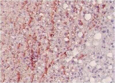 Immunohistochemistry-Paraffin: Nitrotyrosine Antibody (HM.11) [NB600-1024]