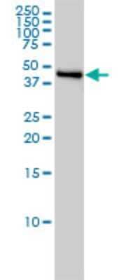 Western Blot: Njmu-R1 Antibody (3F8) [H00064149-M01]