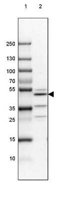 Western Blot: Njmu-R1 Antibody [NBP1-82563]