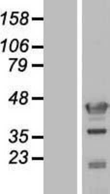 Western Blot: Njmu-R1 Overexpression Lysate [NBL1-08243]