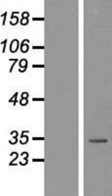 Western Blot: NKX2.2 Overexpression Lysate [NBL1-13661]