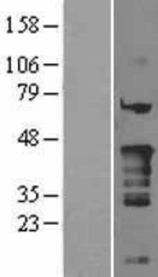 Western Blot: NKX2.5 Overexpression Lysate [NBL1-13659]