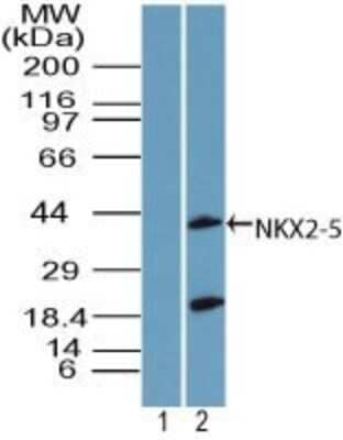 Western Blot: NKX2.5 Antibody [NBP2-24675]