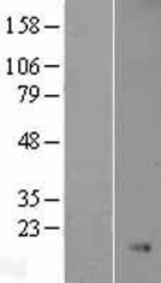 Western Blot: NKX3.1 Overexpression Lysate [NBL1-13662]