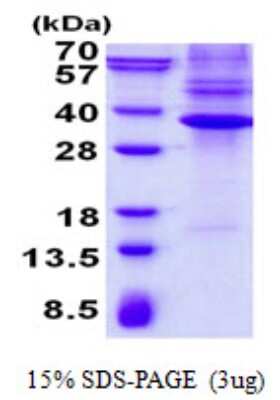 SDS-PAGE: Recombinant Human NKX3.1 His Protein [NBP2-23290]