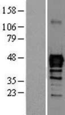 Western Blot: NKX6.1 Overexpression Lysate [NBL1-13663]