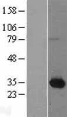 Western Blot: NMNAT-1 Overexpression Lysate [NBL1-13691]