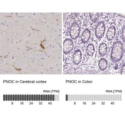 Immunohistochemistry-Paraffin: Nociceptin Antibody [NBP2-58314]