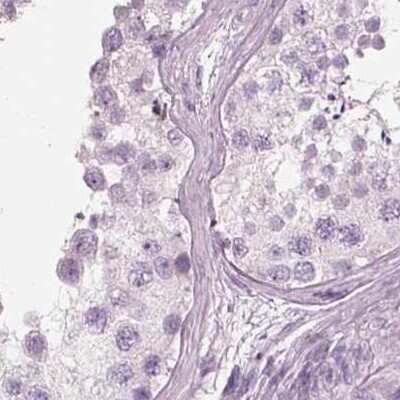 Immunohistochemistry-Paraffin: Nociceptin Antibody [NBP2-58314]