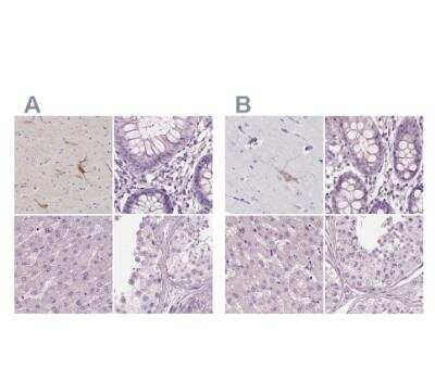 Immunohistochemistry-Paraffin: Nociceptin Antibody [NBP2-58314]