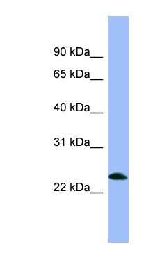 Western Blot: Nociceptin Antibody [NBP1-59307]