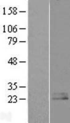 Western Blot: Nociceptin Overexpression Lysate [NBL1-14553]