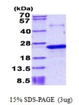 SDS-PAGE: Recombinant Human Nociceptin His Protein [NBP2-23359]