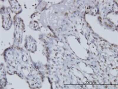 Immunohistochemistry-Paraffin: Nocturnin Antibody (3E8) [H00025819-M01]