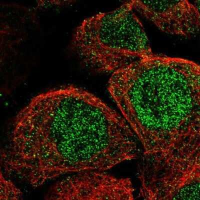 Immunocytochemistry/ Immunofluorescence: Nocturnin Antibody [NBP2-37856]