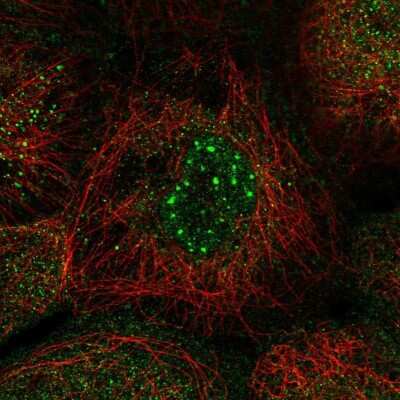 Immunocytochemistry/ Immunofluorescence: Nocturnin Antibody [NBP2-37939]