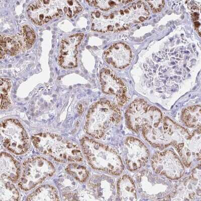 Immunohistochemistry: Nocturnin Antibody [NBP2-37939]