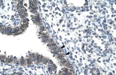 Immunohistochemistry: Nocturnin Antibody [NBP2-87931]