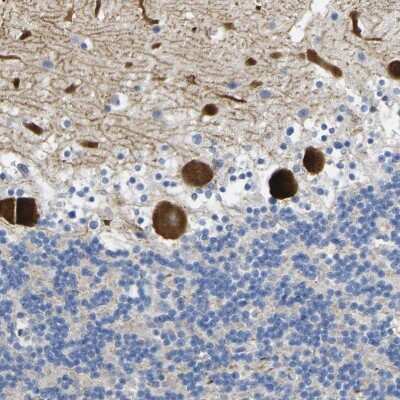 Immunohistochemistry-Paraffin: Nocturnin Antibody [NBP2-37856]