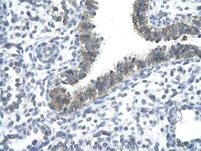 Immunohistochemistry-Paraffin: Nocturnin Antibody [NBP2-87931]