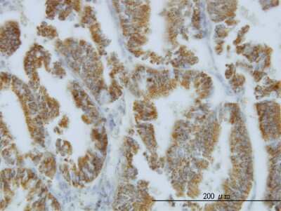 Immunohistochemistry-Paraffin: Nodal Antibody (5C3) [H00004838-M03]