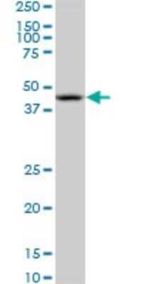 Western Blot: Nodal Antibody (5C3) [H00004838-M03]