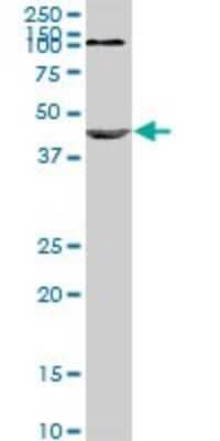 Western Blot: Nodal Antibody (5C3) [H00004838-M03]