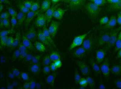 Immunocytochemistry/ Immunofluorescence: Nodal Antibody [NBP1-71686]