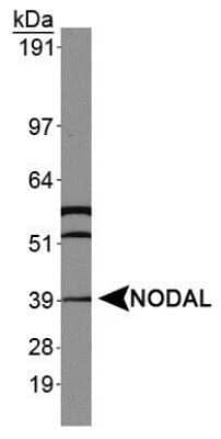 Western Blot: Nodal Antibody [NBP1-71686]