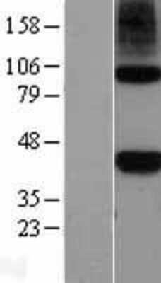 Western Blot: Nodal Overexpression Lysate [NBL1-13706]