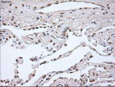 Immunohistochemistry-Paraffin: Noggin Antibody (OTI1H8) [NBP1-47881]