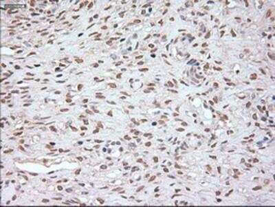 Immunohistochemistry-Paraffin: Noggin Antibody (OTI1H8) [NBP1-47881]