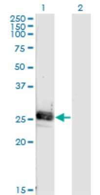 Western Blot: Noggin Antibody (4A1) [H00009241-M04]