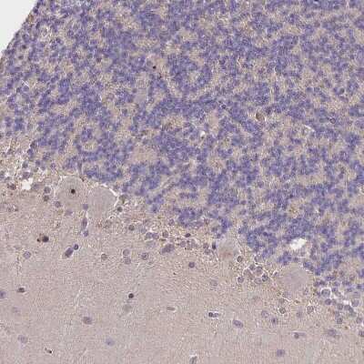 Immunohistochemistry-Paraffin: Noggin Antibody [NBP2-34141]