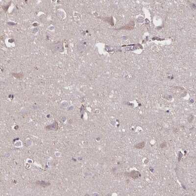 Immunohistochemistry-Paraffin: Noggin Antibody [NBP2-34141]