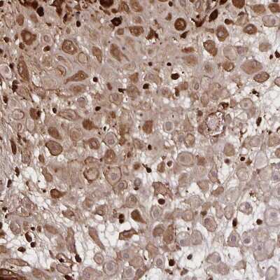 Immunohistochemistry-Paraffin: Noggin Antibody [NBP2-34141]