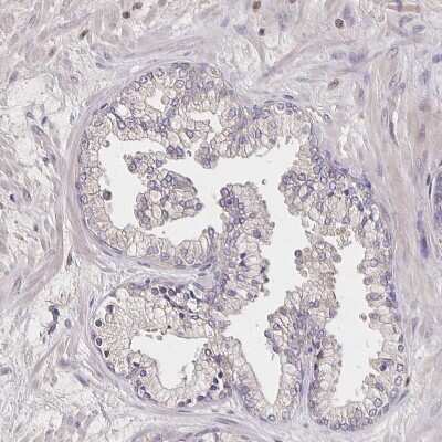 Immunohistochemistry-Paraffin: Noggin Antibody [NBP2-34141]