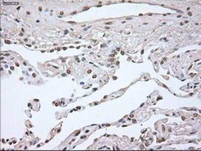 Immunohistochemistry: Noggin Antibody (OTI1H8) - Azide and BSA Free [NBP2-73030]