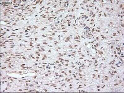Immunohistochemistry: Noggin Antibody (OTI1H8) - Azide and BSA Free [NBP2-73030]