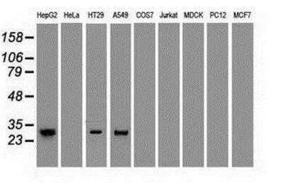 Western Blot: Noggin Antibody (OTI1H8)Azide and BSA Free [NBP2-73030]