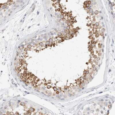 Immunohistochemistry-Paraffin: Nogo Antibody [NBP2-47354]