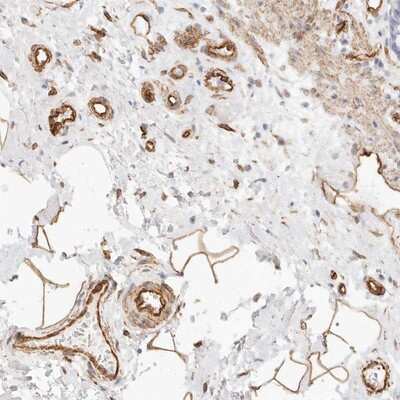 Immunohistochemistry-Paraffin: Nogo B receptor Antibody [NBP1-88252]