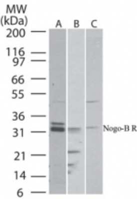 Western Blot: Nogo B receptor Antibody [NBP2-24950]