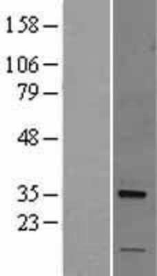 Western Blot: Nogo B receptor Overexpression Lysate [NBL1-13886]