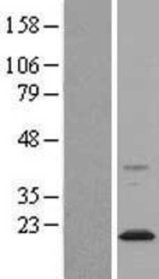 Western Blot: Nogo Overexpression Lysate [NBL1-15612]