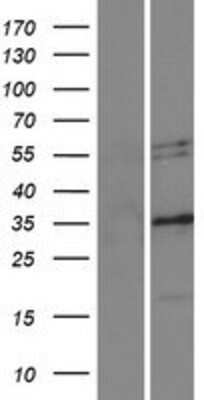 Western Blot: Nogo Overexpression Lysate [NBP2-06628]