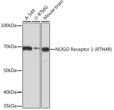 Western Blot: Nogo Receptor/NgR Antibody (1R9A3) [NBP3-16299]